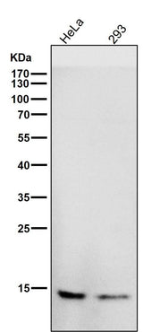 Anti-CDKN2A/p14ARF Rabbit Monoclonal Antibody Boster Bio