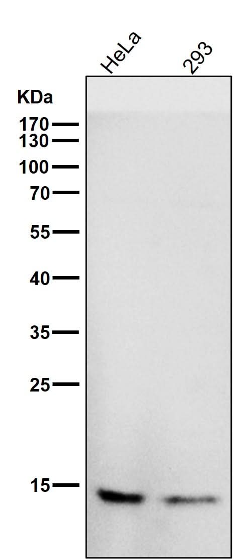 Anti-CDKN2A/p14ARF Rabbit Monoclonal Antibody Boster Bio