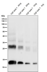 Anti-TGF beta 1 Rabbit Monoclonal Antibody Boster Bio