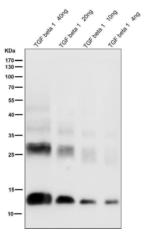 Anti-TGF beta 1 Rabbit Monoclonal Antibody Boster Bio