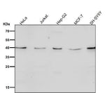 Anti-CTLA4 (CD152) Monoclonal Antibody Boster Bio