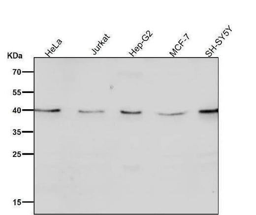 Anti-CTLA4 (CD152) Monoclonal Antibody Boster Bio