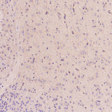 Anti-EGFR (ErbB 1) Monoclonal Antibody Boster Bio