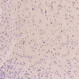 Anti-EGFR (ErbB 1) Monoclonal Antibody Boster Bio