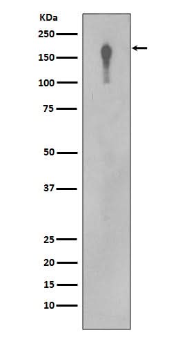 Anti-EGFR Rabbit Monoclonal Antibody Boster Bio