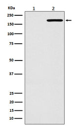 Anti-EGFR(L858R mutation) Rabbit Monoclonal Antibody Boster Bio