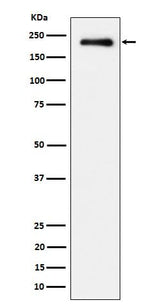 Anti-Phospho-EGFR (Y845) Rabbit Monoclonal Antibody Boster Bio