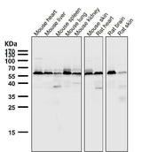 Anti-AKT1 + AKT2 + AKT3 Rabbit Monoclonal Antibody Boster Bio