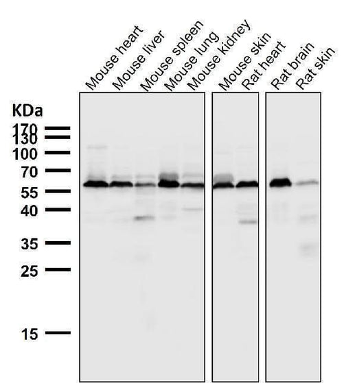 Anti-AKT1 + AKT2 + AKT3 Rabbit Monoclonal Antibody Boster Bio