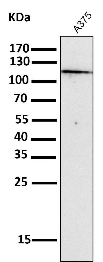 Anti-NALP3 NLRP3 Rabbit Monoclonal Antibody Boster Bio