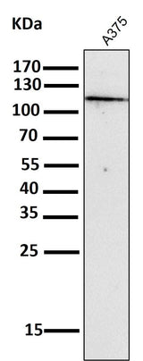Anti-NALP3 NLRP3 Rabbit Monoclonal Antibody Boster Bio