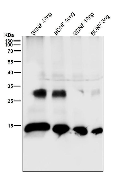 Anti-BDNF Rabbit Monoclonal Antibody Boster Bio