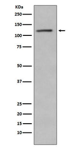 Anti-Phospho-Retinoblastoma (S780) RB1 Rabbit Monoclonal Antibody Boster Bio