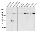 Anti-Rb RB1 Rabbit Monoclonal Antibody Boster Bio