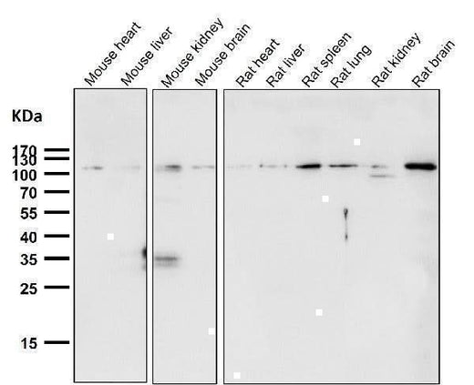 Anti-Rb RB1 Rabbit Monoclonal Antibody Boster Bio