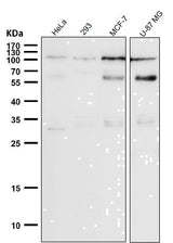Anti-Phospho-Rb (S780) Rabbit Monoclonal Antibody Boster Bio