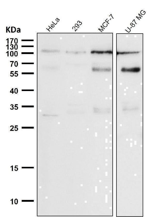 Anti-Phospho-Rb (S780) Rabbit Monoclonal Antibody Boster Bio