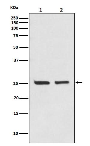 Anti-Bcl-2 Rabbit Monoclonal Antibody Boster Bio