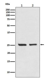 Anti-Bcl-2 Rabbit Monoclonal Antibody Boster Bio