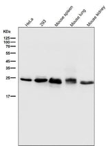 Anti-Bcl-2 Rabbit Monoclonal Antibody Boster Bio
