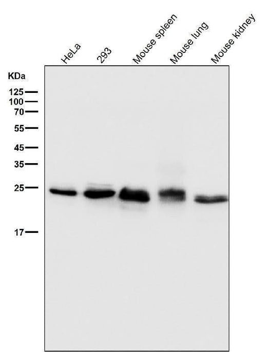 Anti-Bcl-2 Rabbit Monoclonal Antibody Boster Bio
