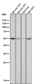 Anti-Caspase-8 CASP8 Rabbit Monoclonal Antibody Boster Bio