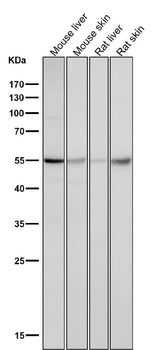 Anti-Caspase-8 CASP8 Rabbit Monoclonal Antibody Boster Bio