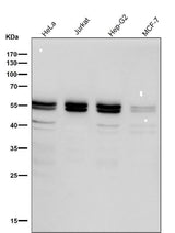 Anti-Caspase-8 Rabbit Monoclonal Antibody Boster Bio