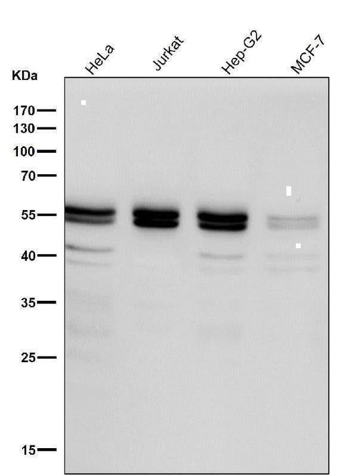 Anti-Caspase-8 Rabbit Monoclonal Antibody Boster Bio