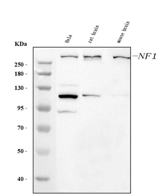 Anti-Neurofibromin/NF1 Antibody Picoband® (monoclonal, 4F8B7 Boster Bio