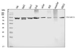 Anti-Prothrombin Antibody Picoband® (monoclonal, 5B6G1 Boster Bio