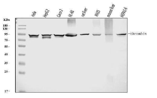 Anti-Prothrombin Antibody Picoband® (monoclonal, 5B6G1 Boster Bio