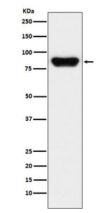 Anti-Prothrombin F2 Monoclonal Antibody Boster Bio