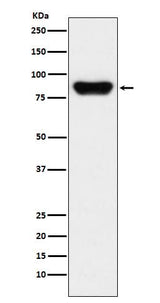 Anti-Prothrombin F2 Monoclonal Antibody Boster Bio
