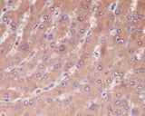 Anti-Caspase-1 CASP1 Rabbit Monoclonal Antibody Boster Bio