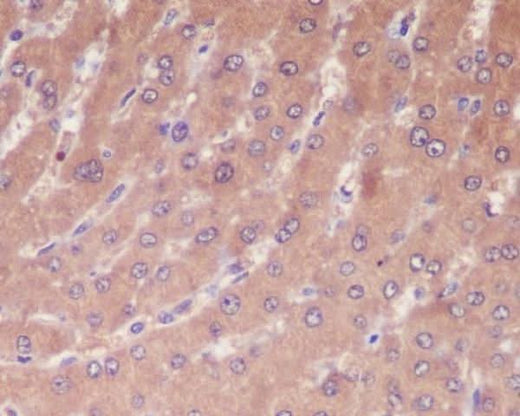 Anti-Caspase-1 CASP1 Rabbit Monoclonal Antibody Boster Bio