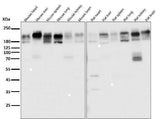 Anti-P Glycoprotein ABCB1 Rabbit Monoclonal Antibody Boster Bio