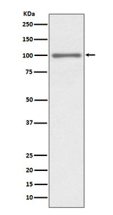 Anti-KMT6 / EZH2 Rabbit Monoclonal Antibody Boster Bio