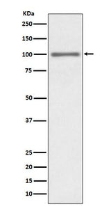 Anti-KMT6 / EZH2 Rabbit Monoclonal Antibody Boster Bio