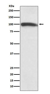 Anti-KMT6 / EZH2 Rabbit Monoclonal Antibody Boster Bio