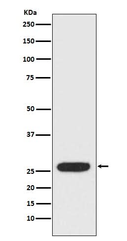 Anti-StAR Rabbit Monoclonal Antibody Boster Bio
