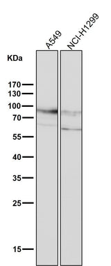 Anti-CD44 Rabbit Monoclonal Antibody Boster Bio