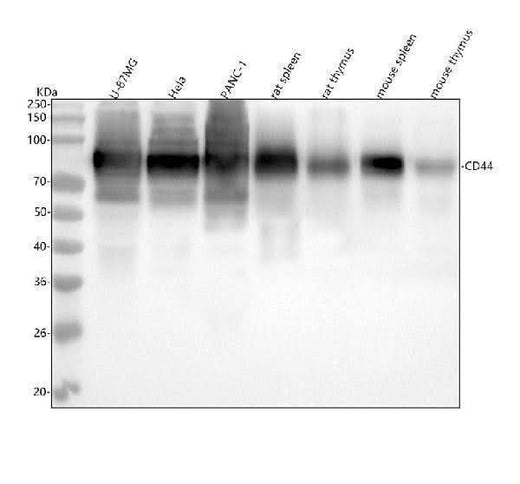 Anti-CD44 Rabbit Monoclonal Antibody Boster Bio