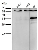 Anti-ER alpha ESR1 Rabbit Monoclonal Antibody Boster Bio