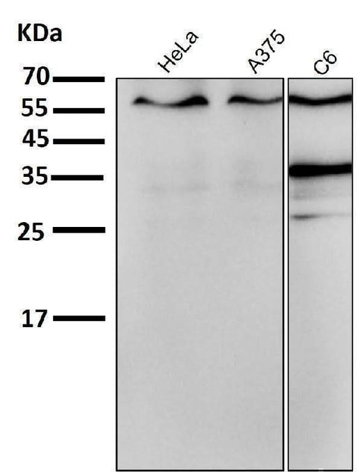 Anti-ER alpha ESR1 Rabbit Monoclonal Antibody Boster Bio