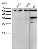 Anti-ER alpha ESR1 Rabbit Monoclonal Antibody Boster Bio
