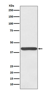 Anti-Haptoglobin HP Rabbit Monoclonal Antibody Boster Bio