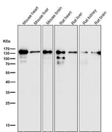Anti-pan Cadherin 1 CDH1 Rabbit Monoclonal Antibody Boster Bio