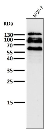 Anti-E Cadherin Rabbit Monoclonal Antibody Boster Bio
