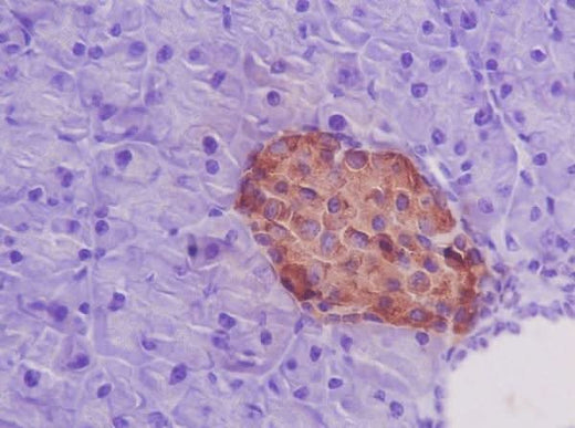 Anti-Insulin Rabbit Monoclonal Antibody Boster Bio